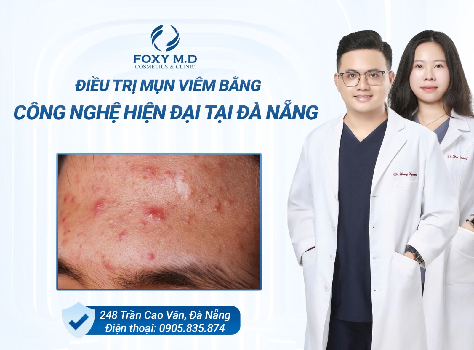 ĐIỀU TRỊ MỤN VIÊM BẰNG CÔNG NGHỆ HIỆN ĐẠI TẠI ĐÀ NẴNG